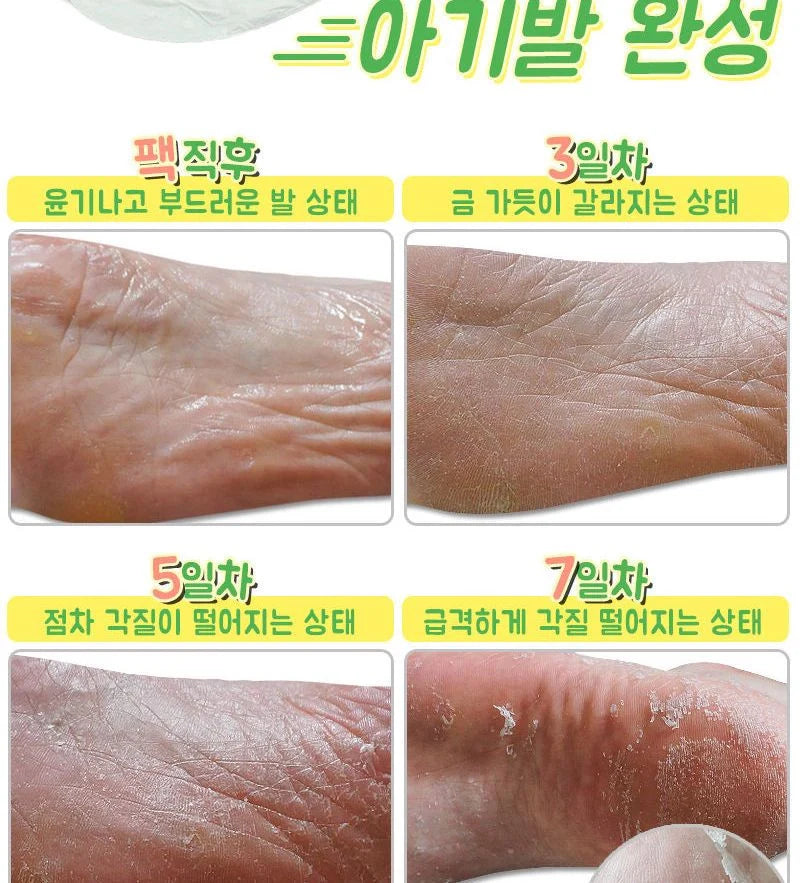 Elizavecca - Witch Piggy Hell Pore Turtle's Foot Pack