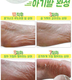 Elizavecca - Witch Piggy Hell Pore Turtle's Foot Pack